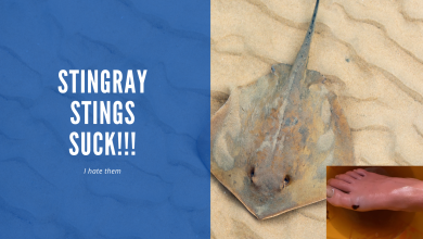 A stingray on the sand with a close-up of a sting wound on a foot, alongside text stating "STINGRAY STINGS SUCK!!! I hate them".
